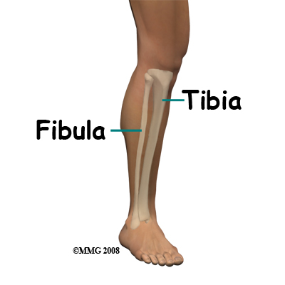 Spiral Fracture: Healing Time, Tibia, and Fibula