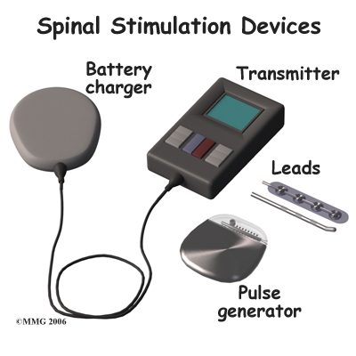 Rechargeable Spinal Cord Stimulators for Chronic Pain