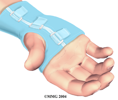 Physical Therapy For Carpal Tunnel